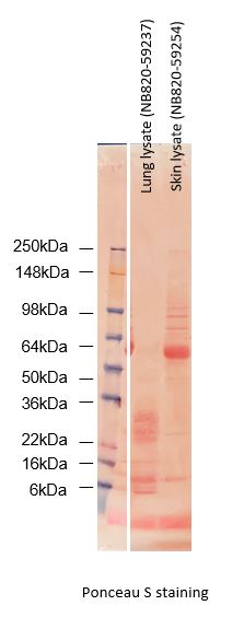 Human Lung Whole Tissue Lysate (Adult Whole Normal) NB820-59237